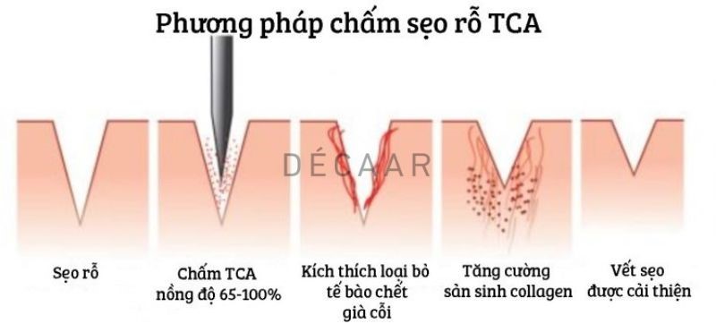 trichloroacetic acid